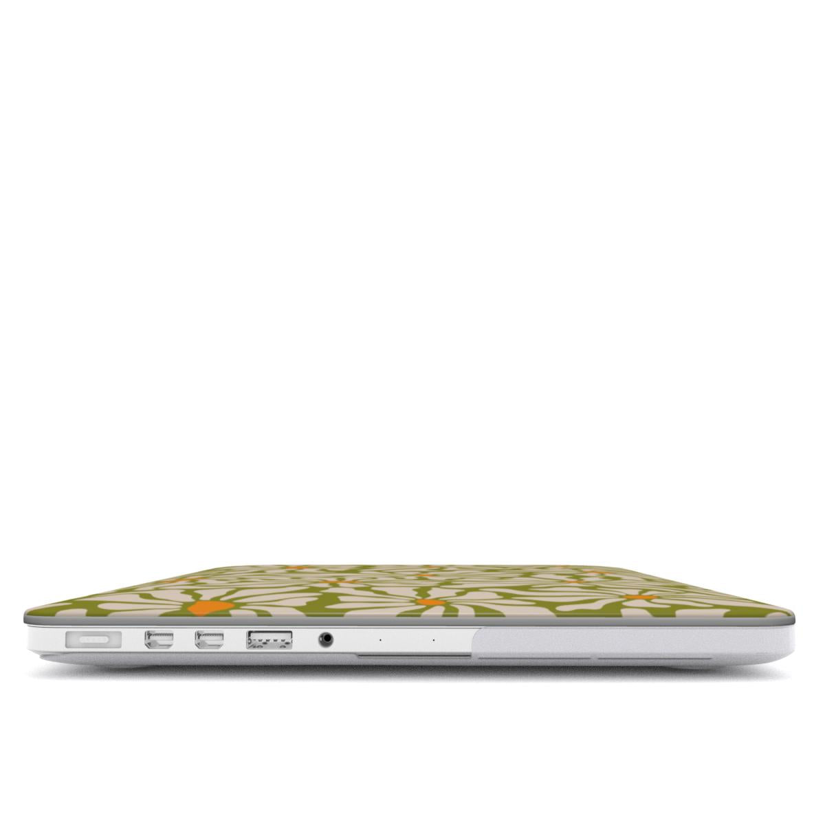 Swazy - MacBook Case