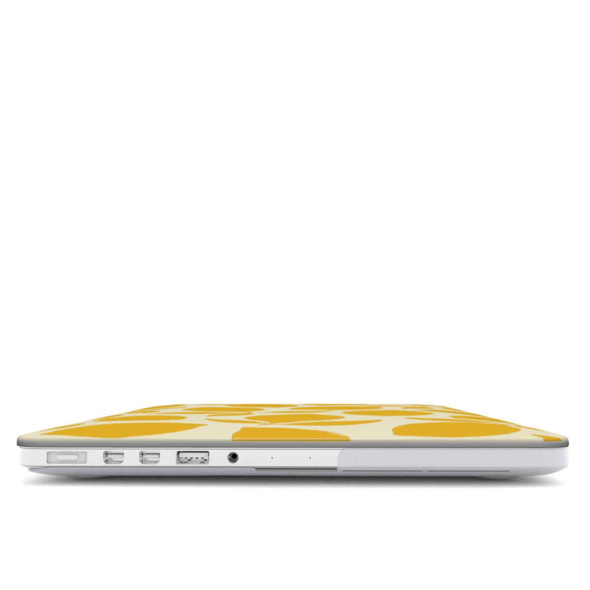 Lemonade - MacBook Case