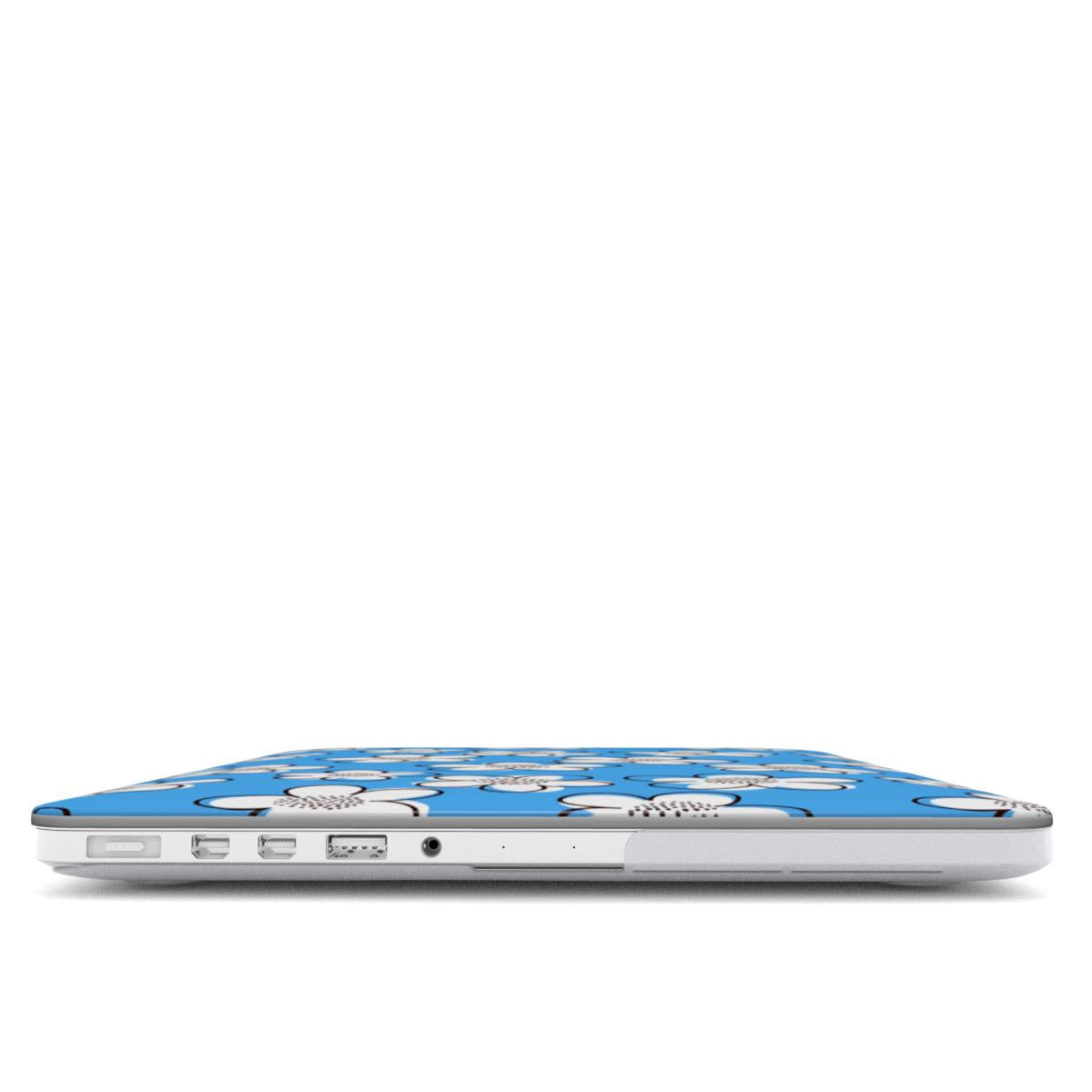 Daybliss - MacBook Case
