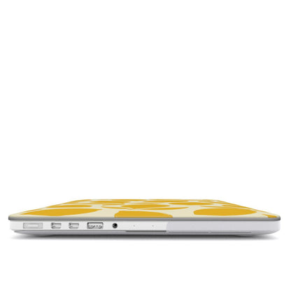 Lemonade - MacBook Case