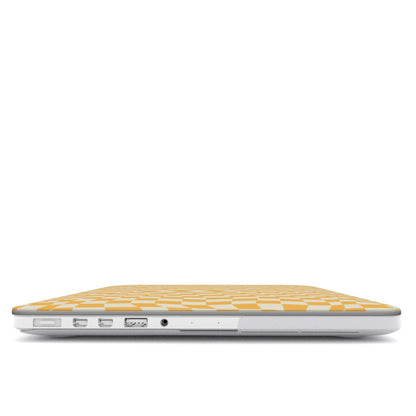 Fizz - MacBook Case