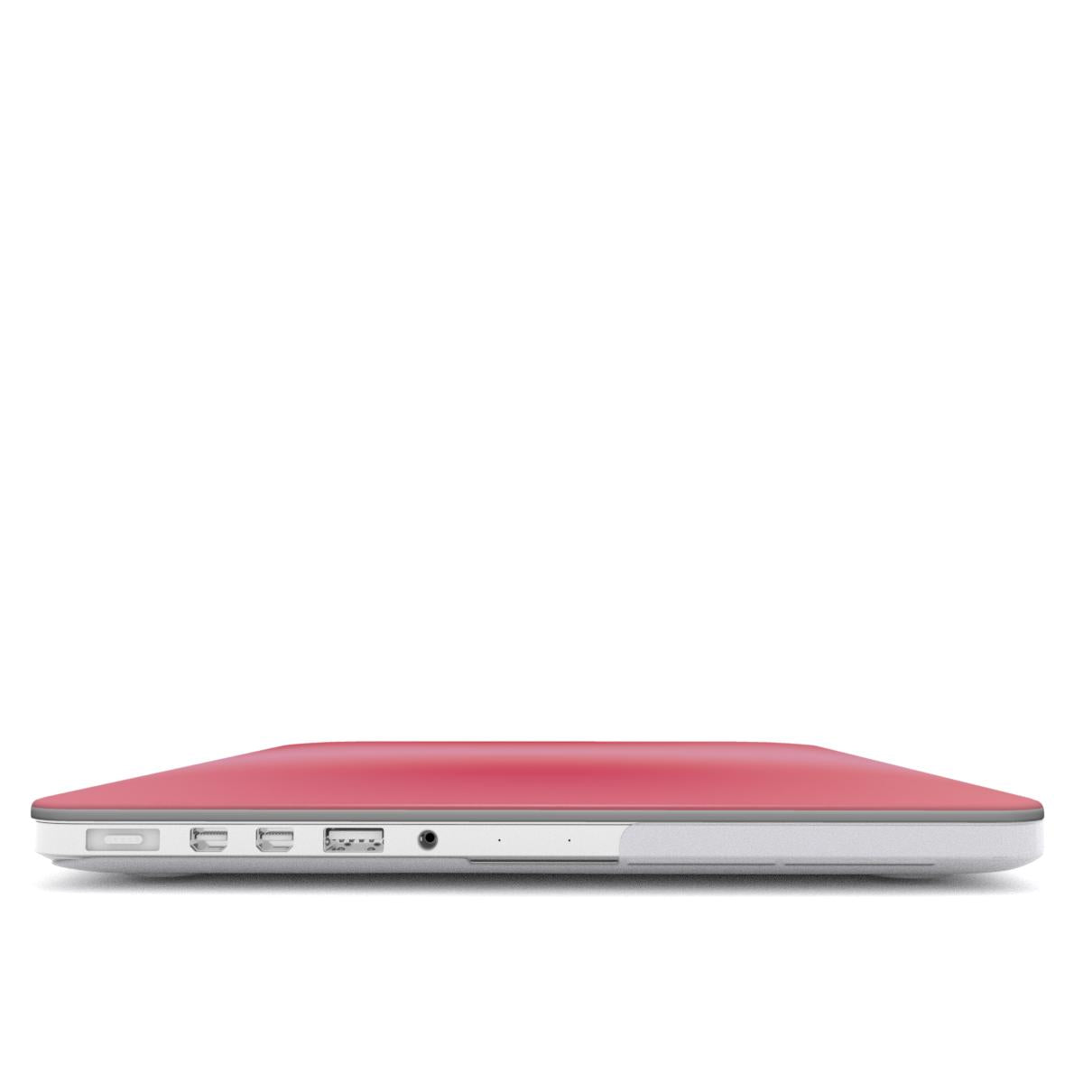 Glow Up - MacBook Case